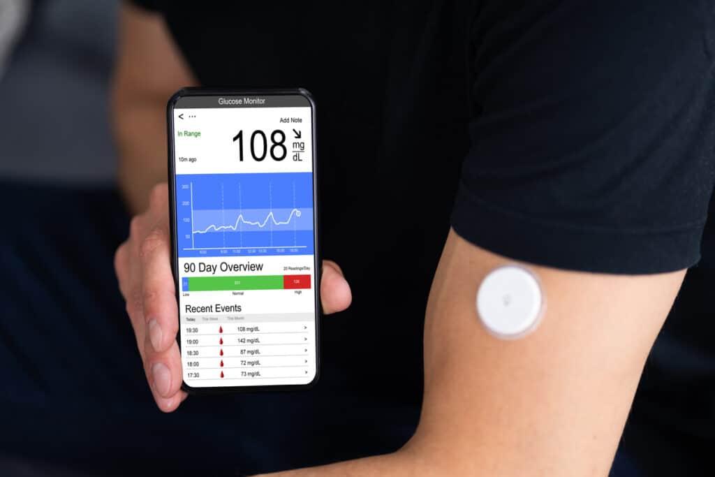 CGM for weight loss review