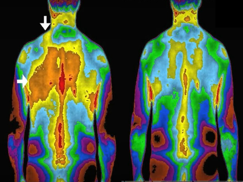 free electrons reducing inflammation before and after thermography photos